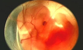 Nhau thai là 'bệnh phẩm', không phải thuốc