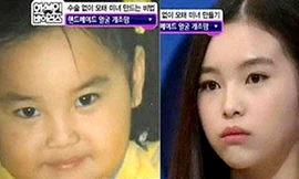 Mẹ Hàn Quốc 'nắn' mặt cho con bằng mát-xa và thìa