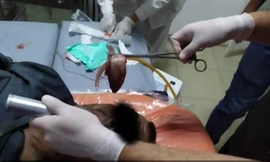 Một người bị con cá sống chui vào cổ họng suýt ngạt thở, lý do thì bạn không tin nổi đâu