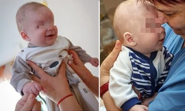 Em bé sinh ra thiếu đi đôi mắt nên bị mẹ bỏ rơi, giờ đã tìm được gia đình yêu thương mình