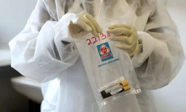 Biến thể SARS-CoV-2 của Nam Phi “còn đáng lo ngại hơn biến thể ở Anh”, lý do vì sao?