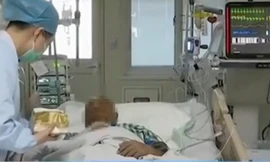 Nặn mụn từ lần này sang lần khác, một người bị biến chứng viêm phổi kép, xẹp cả 2 bên phổi