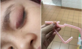 Người mẹ vô ý làm rơi mảnh mắc áo gãy, tai nạn bất ngờ đã xảy ra với cô con gái nhỏ