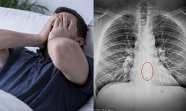 Người đàn ông làm mất Airpods... trong lúc ngủ, khi tới bệnh viện thì biết sự thật bàng hoàng