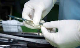 Em bé nuốt 2 viên nam châm