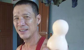 Kỳ lạ quả trứng gà hồ lô