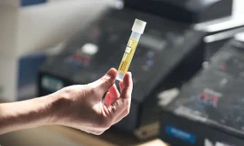 Vật liệu cho cấy ghép y tế và xây dựng được làm từ… nước tiểu