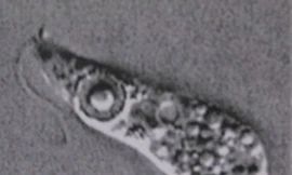 Amip ăn não người bị nghi giết chết một em bé