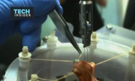 Robot phẫu thuật tự động giỏi hơn bác sĩ