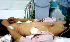 Nghi án chồng đâm chết vợ rồi tự sát