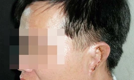 Khai trừ Đảng Phó bí thư xã bị người tình xẻo tai