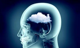 Những người đã khỏi COVID-19 có nguy cơ cao bị rối loạn tâm thần, sa sút trí tuệ và “sương mù não”. Ảnh: Getty Images.