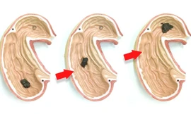 Robot mềm được thiết kế để đưa vào cơ thể người, thực hiện các nhiệm vụ y tế. Minh họa: Mashable.