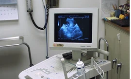 Trong khi làm tình nguyện tại một phòng khám sản phụ khoa, vị bác sĩ siêu âm gặp 69 bà bầu. Ảnh: IndiaMART.