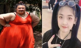 Bị bạn trai đá vì quá béo, cô gái nặng 253kg 'lột xác' ngoạn mục