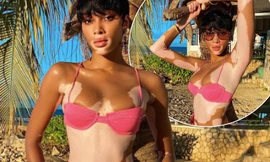 Winnie Harlow quyến rũ hút hồn giữa biển tuyệt đẹp ở Jamaica