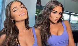 Hoa hậu Hoàn vũ Olivia Culpo quyến rũ rạng ngời ở Miami