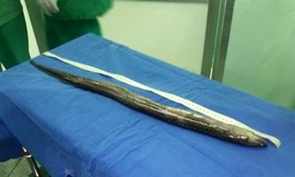 Nghịch dại, cá dài hơn nửa mét chui vào hậu môn