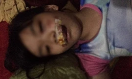 Bé gái N.T.A.T. bị chó "điên" tấn công, phải khâu 13 mũi.