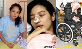 Những sao nữ châu Á từng bị chồng bạo hành dã man trong nhiều năm