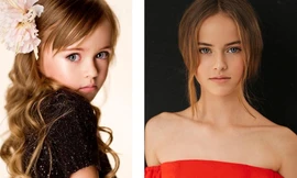 ‘Cô bé đẹp nhất thế giới' người Nga giờ ra sao?