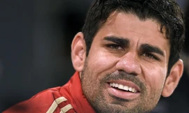 Khuôn mặt Costa trông già hơn tuổi 25