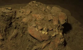 Hộp sọ và răng hàm của người phụ nữ được chôn cất cách đây 7.200 năm ở Indonesia.