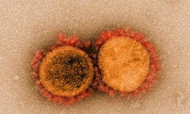 Sự truyền nhiễm của virus SARS-CoV-2 qua ống kính hiển vi điện tử.