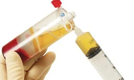 Huyết tương có thể tạo ra kháng thể tiêu diệt virus SARS-CoV-2