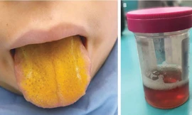 9 ca bệnh kỳ quặc nhất năm 2021 