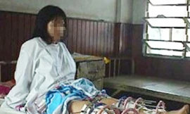 Một bệnh nhân đang trong quá trình thực hiện kéo dài chân (ảnh minh họa)