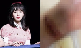 Nữ idol Hàn Quốc rạch tay tự tử gây sốc, bất ngờ nhắc đến Sulli