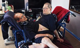 Cộng đồng mạng tiễn biệt cặp song sinh dính liền sống thọ nhất thế giới vừa qua đời