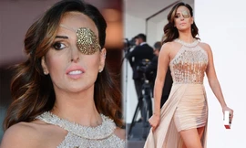 Bi kịch của nữ ca sĩ bịt một mắt lên thảm đỏ LHP Venice