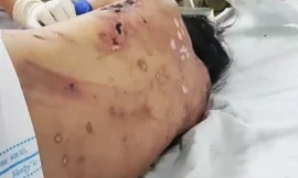 Nữ tiếp viên tố bị chủ ép bán dâm, đánh gãy xương, tra tấn như thời trung cổ