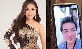 Hồng Ngọc lộ gương mặt biến dạng vì bỏng nặng khiến dân mạng xót xa