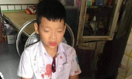 Nhà trường nói gì vụ người đàn ông đấm hộc máu mồm học sinh lớp 1