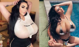 Người mẫu Nga kể khổ, liên tục bị quấy rối vì có vòng một tự nhiên khổng lồ