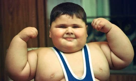 ‘Đứa trẻ nặng nhất thế giới’ qua đời ở tuổi 21