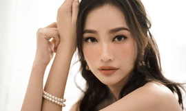 Gương mặt ngày càng khác lạ của Trúc Diễm sau một năm tiết lộ bị bệnh cường giáp