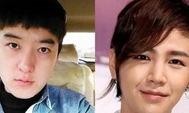 Phẫu thuật thẩm mỹ giống sao Hàn để… tưởng nhớ bạn gái