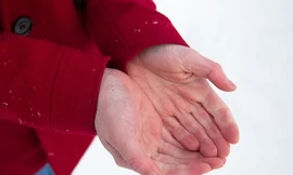 Nguyên nhân gây hiện tượng bỏng lạnh ?