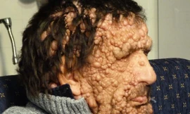 Anh Vinicio Riva, 53 tuổi