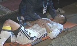 Van Persie nằm cáng rời sân sau chấn thương vùng mắt.