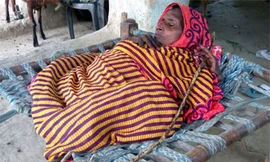 Chứng bệnh lạ khiến bà Shanti thường xuyên sống trong cảnh đau nhức toàn thân. Ảnh: Caters.