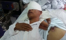 Anh Ký đang được điều trị tại bệnh viện và vết thương bị gấu tấn công ở chân (ảnh nhỏ).