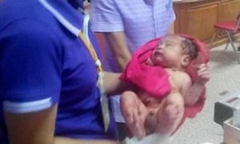 Bé sơ sinh sống sót thần kỳ sau khi bị đâm và chôn sống