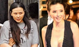 Tiêu Thục Thận nhận show khi vừa phẫu thuật ung thư khiến khán giả lo lắng