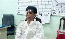 Bản tin 8H: Danh tính kẻ cầm kéo tấn công công an phường ở TP HCM