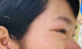 Bản tin 8H: Thầy giáo bị tố xông vào nhà hành hung cô giáo của con